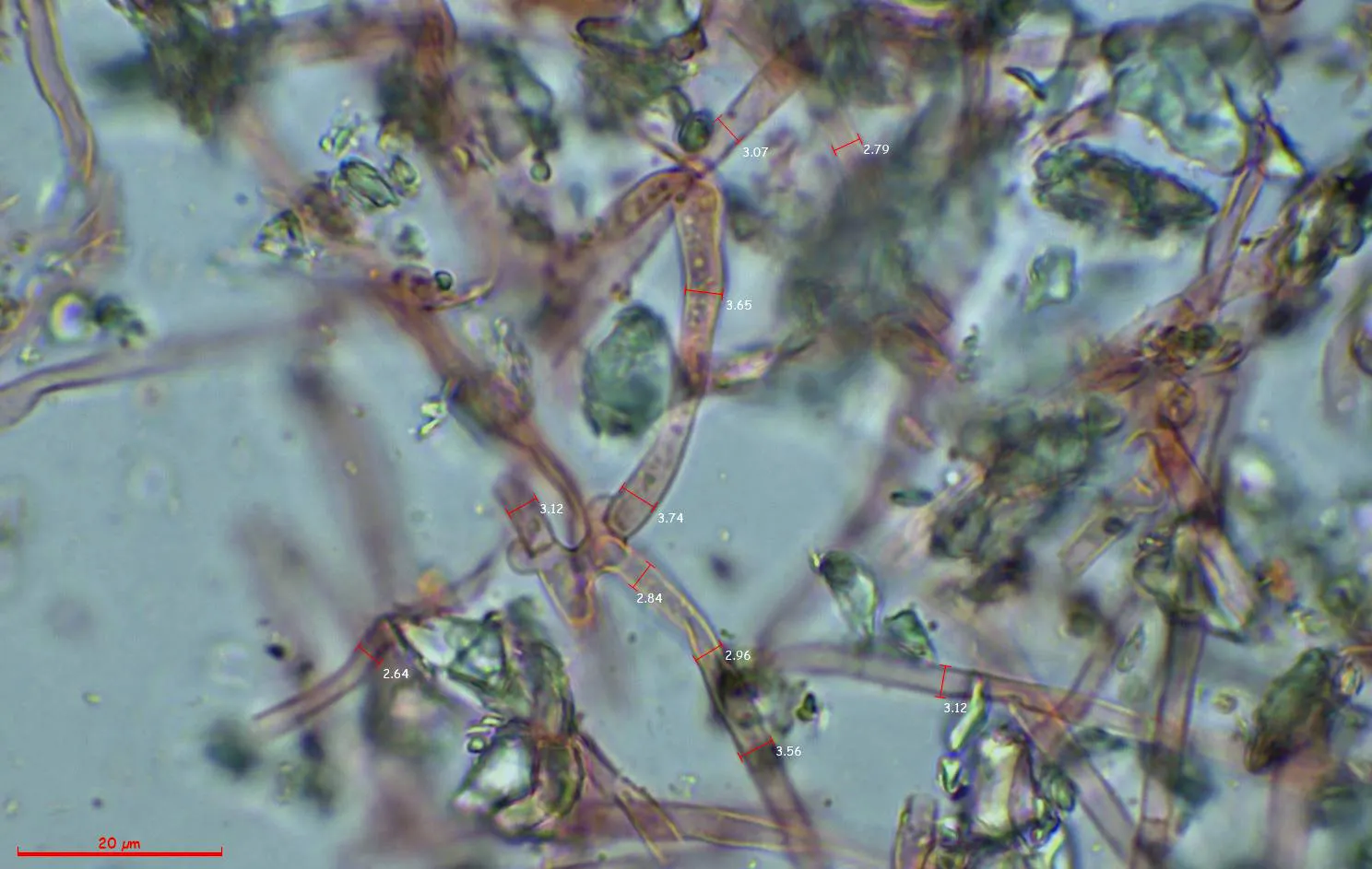Microscopía de Trechispora cohaerens - 10 - Anchura hifas subiculares